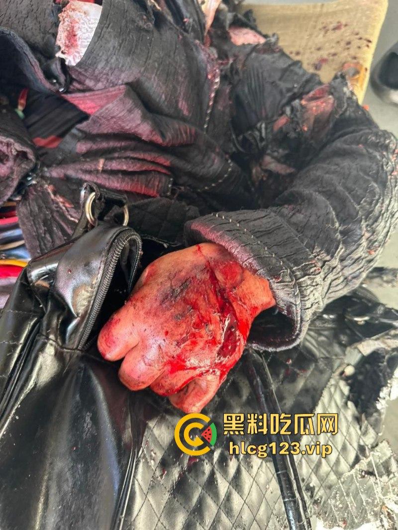 坐等看戏!伊朗对以色列的导弹袭击已结束 美准备好对抗伊朗?内含血腥无码画面 慎入!!!-7