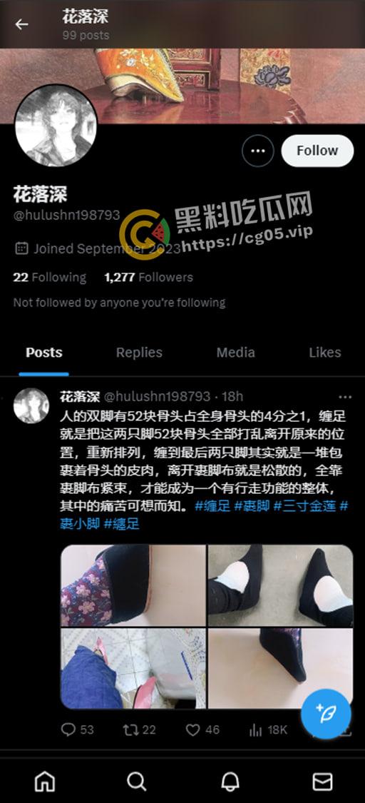 新时代裹脚女性!00后女生爱上裹脚 推特分享裹脚经历 把脚缠到骨折变形 吓人!-1