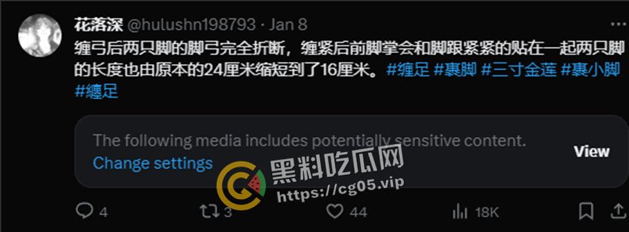 新时代裹脚女性!00后女生爱上裹脚 推特分享裹脚经历 把脚缠到骨折变形 吓人!-2