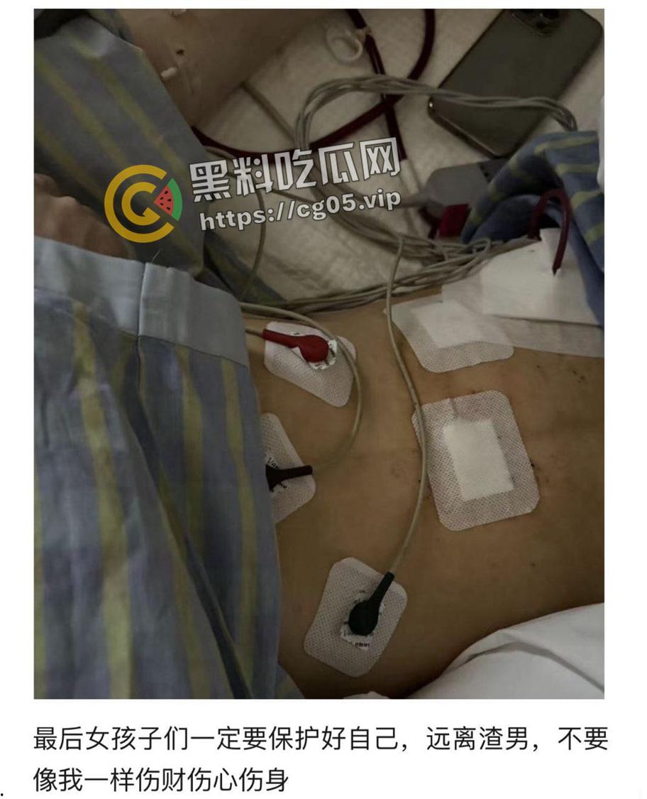 婊子配狗 天长地久！长沙男模加凡本名韩飞 渣男渣女撕逼故事 臭逼配烂屌 没一个无辜的-28