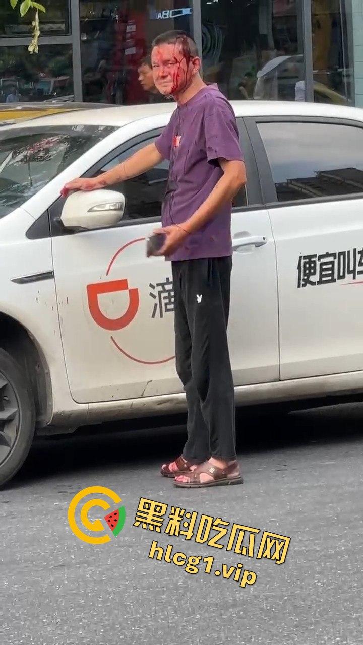 女子因价格争执叫来老公,掏出扳手开瓢,赔偿金额够买辆新车!-6