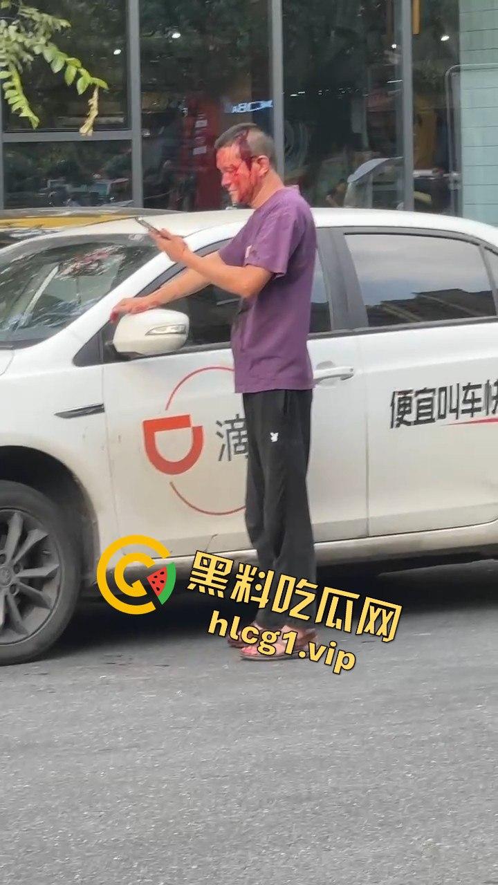 女子因价格争执叫来老公,掏出扳手开瓢,赔偿金额够买辆新车!-8