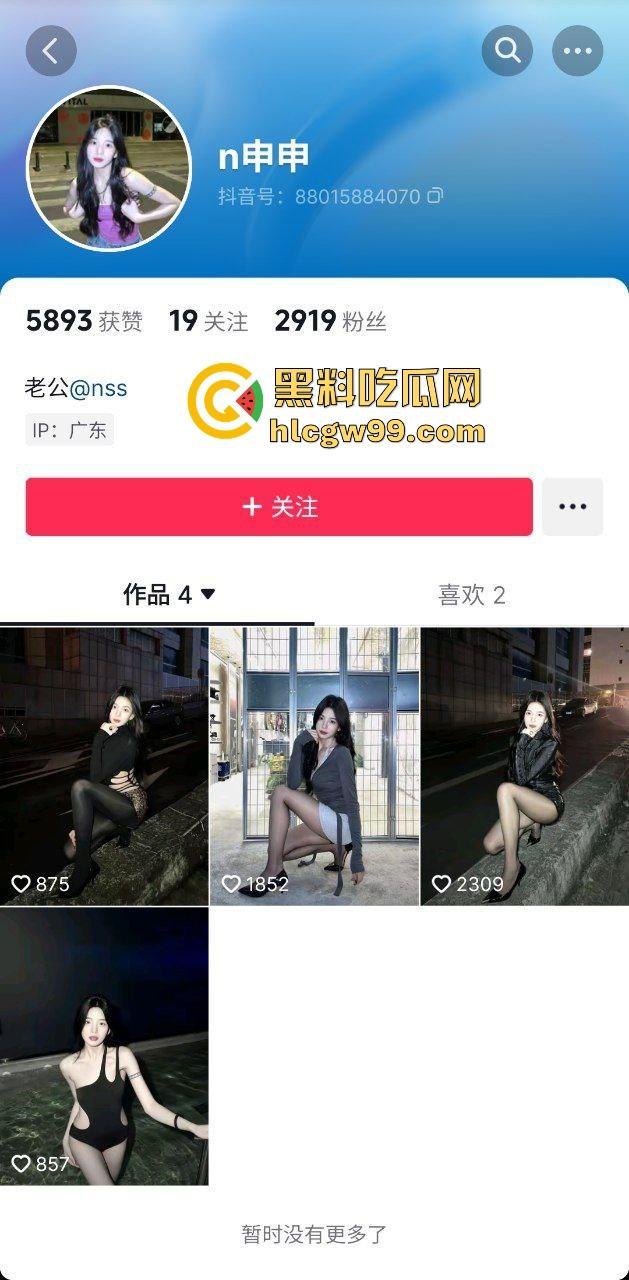 抖音极品黑丝御姐骚鸡【nss】早期诱惑露奶淫荡私拍被曝光,竟然还与大哥开房性交易!原创独家流出!-2