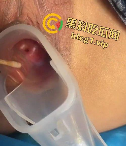 医生偷拍年轻嫩妹王雪检查全程!双腿大开取白带,清纯妹子惨遭曝光!-7