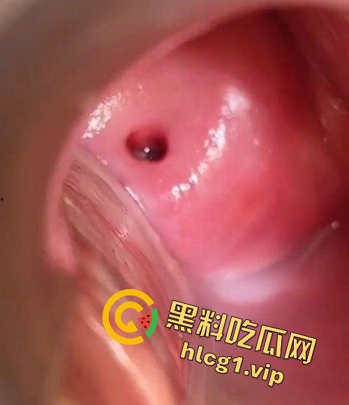 医生偷拍年轻嫩妹王雪检查全程!双腿大开取白带,清纯妹子惨遭曝光!-8