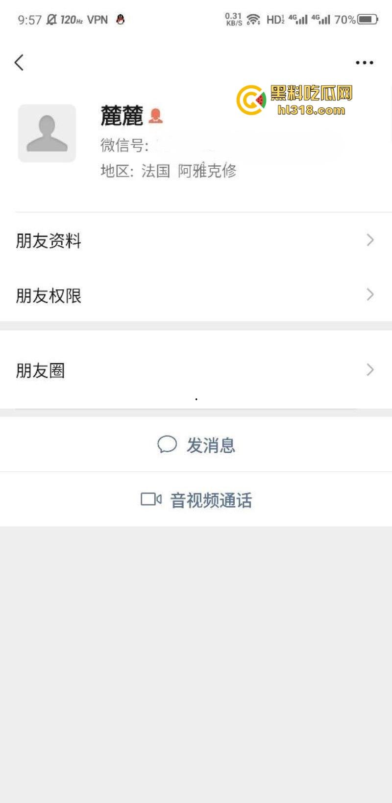 极品巨乳学生妹【林麓】网调视频曝光，背男友拍露脸自慰视频约炮金主，湿漉嫩逼与巨乳一览无余！-1