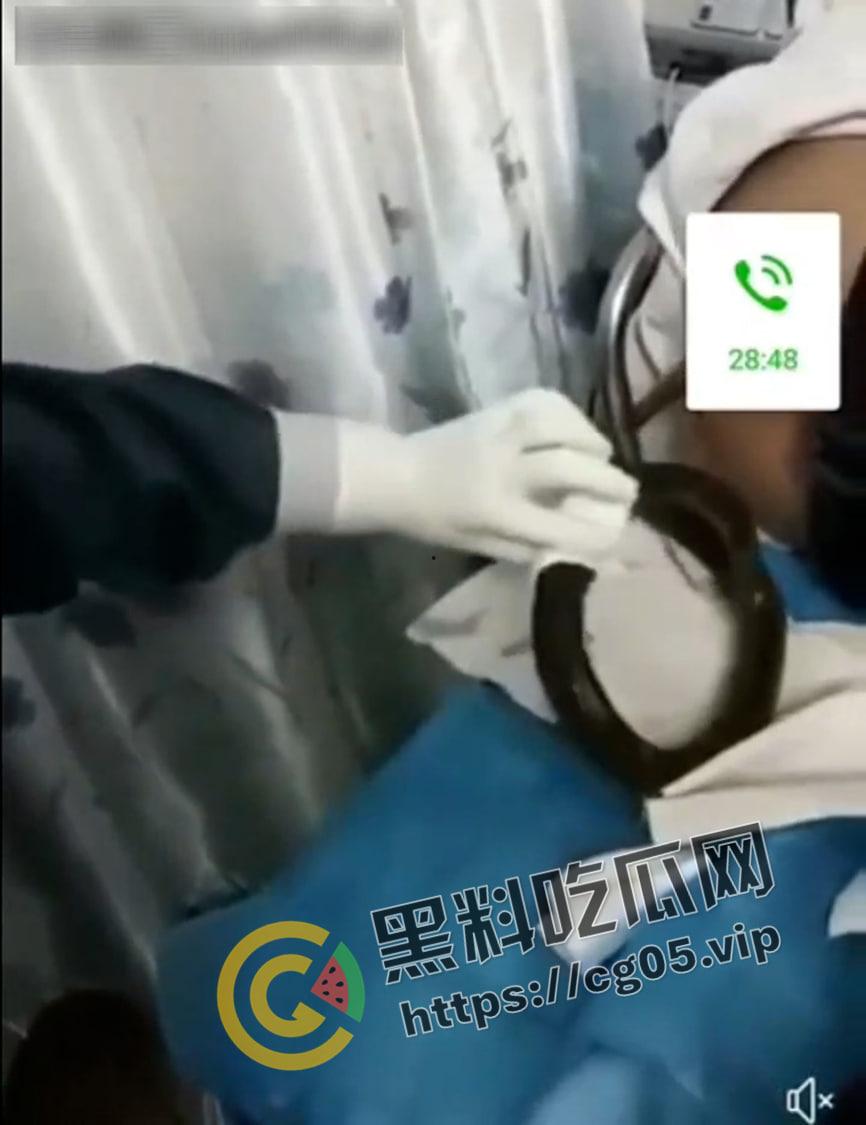 黄鳝入肛 一去不回 整活把自己整进医院了 医生扯出来半米长的黄鳝惊呆了-5