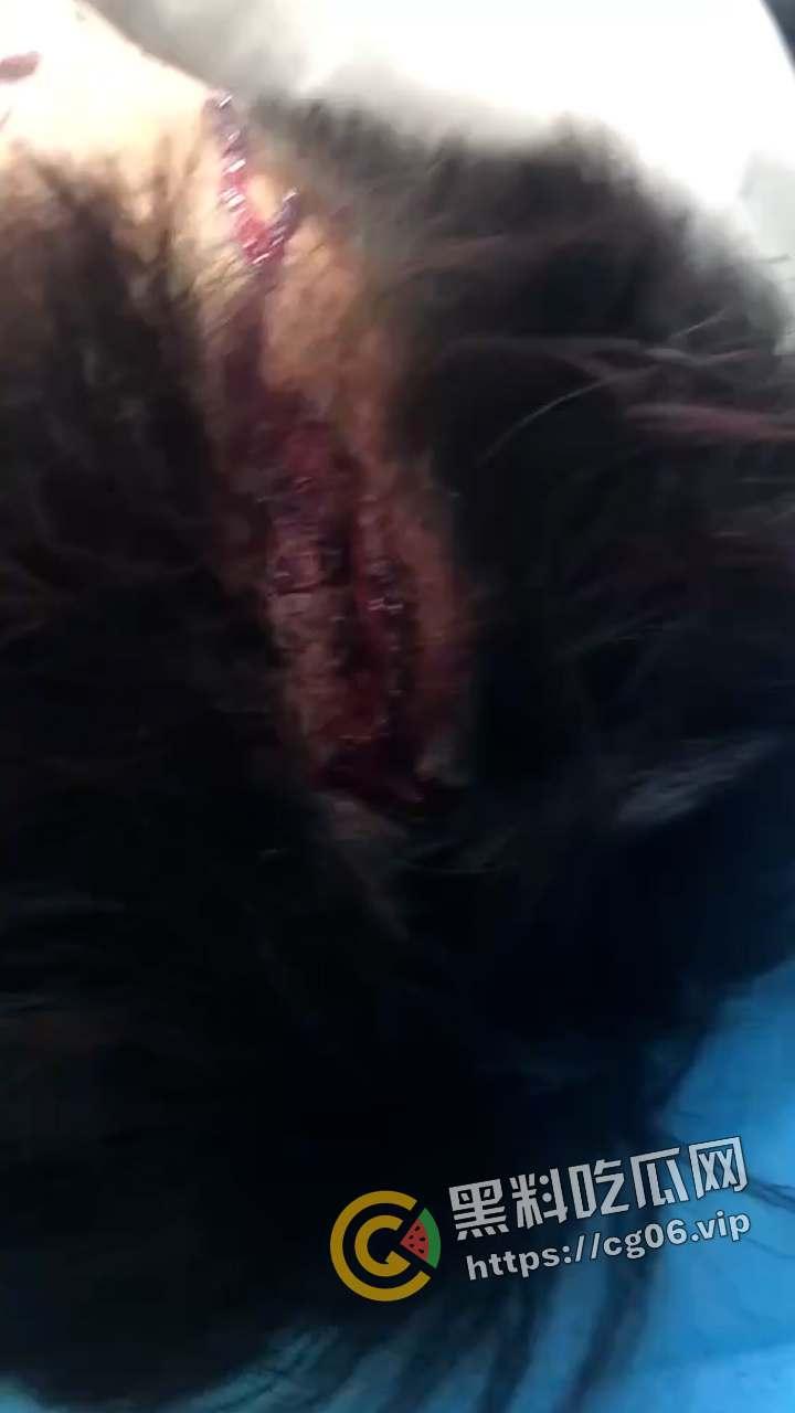 精神小伙1v3！小伙偷情兄弟女朋友 反被女人诬陷 带着闺蜜一起打 头干裂开了  现场血腥画面曝光-6