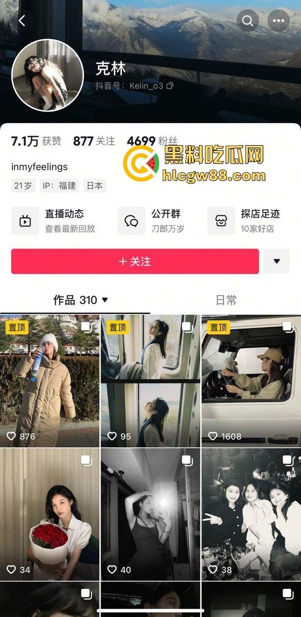 抖音厦门母狗【黄淮北】到处约炮聊骚居家狂热自慰 出去约炮时胸口的挂坠被实锤本人无疑!-1