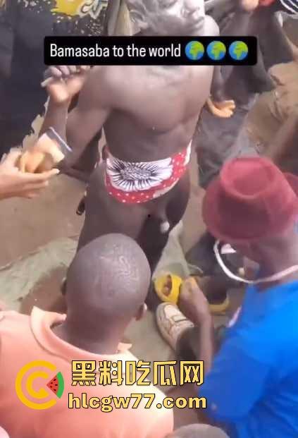 非洲部落割包皮 这也太生猛了吧 包皮一拉一刀下去直接割掉 这老哥全程面无表情!-3