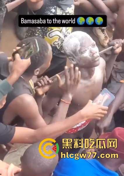 非洲部落割包皮 这也太生猛了吧 包皮一拉一刀下去直接割掉 这老哥全程面无表情!-4