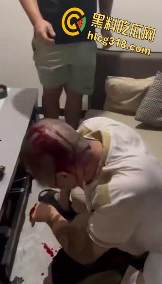 中国绑匪在菲律宾内讧,绑架国人生意惨淡,上演血腥狗咬狗,头破血流枪口相向 !-6