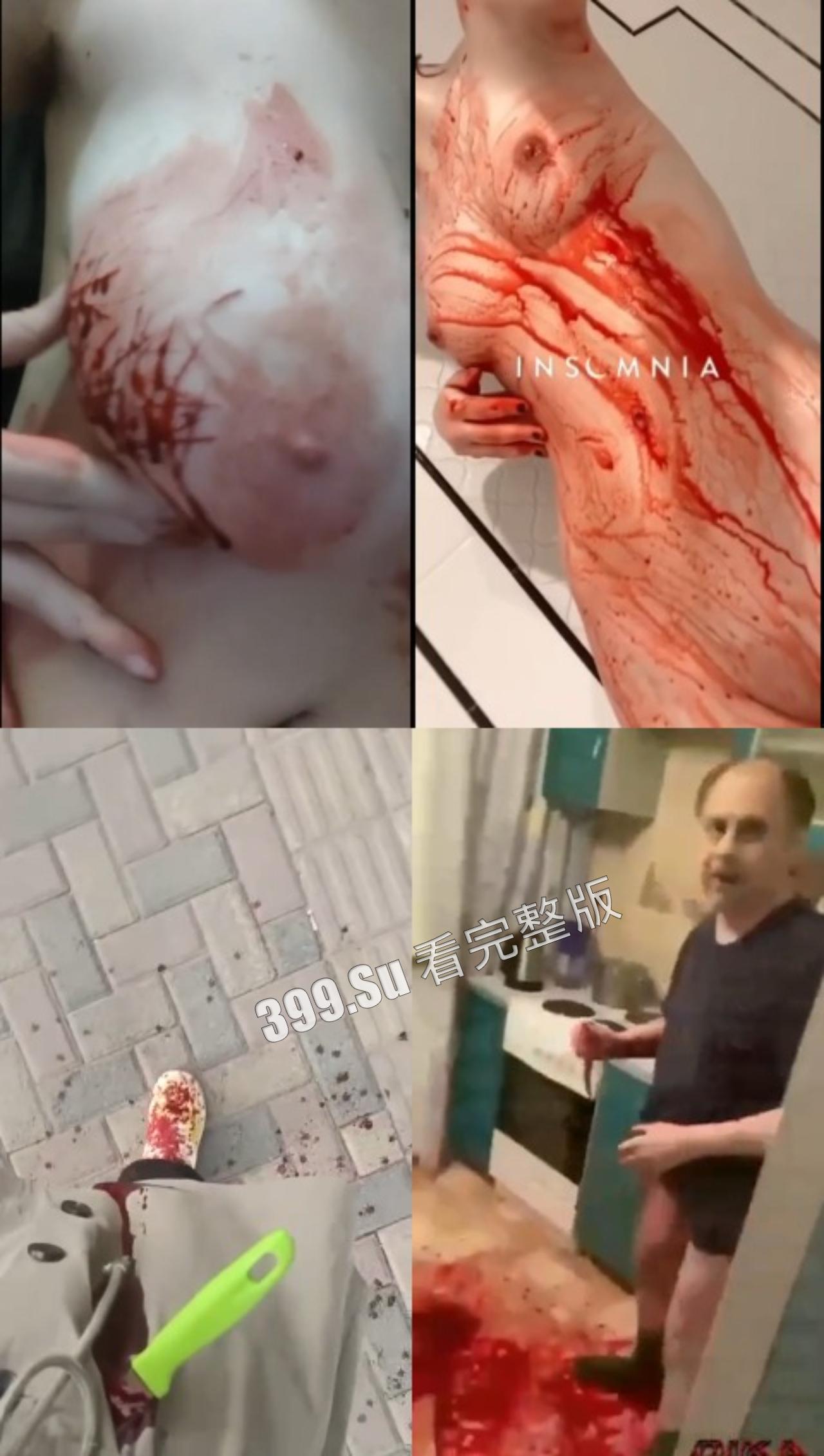 慎点！！！自残篇  身体发肤，受之父母，请爱自己（视频越往后越血腥）-6