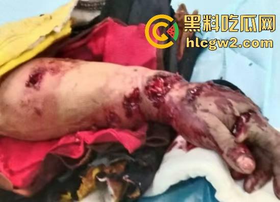 黑龙江勃利县长太村惊现野生东北虎入村 咬伤65岁大爷 大爷吃瓜看虎差点被虎吃 大爷还是大爷！-9