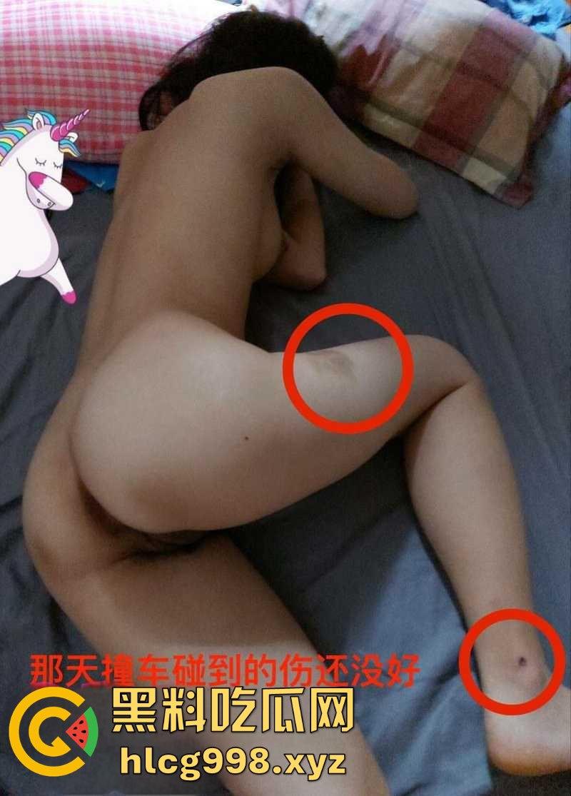 26岁姑娘被撞腿、被日逼!车主套路不断不懈努力搭讪成功,小仙女从拒绝到沦陷的全过程!-9