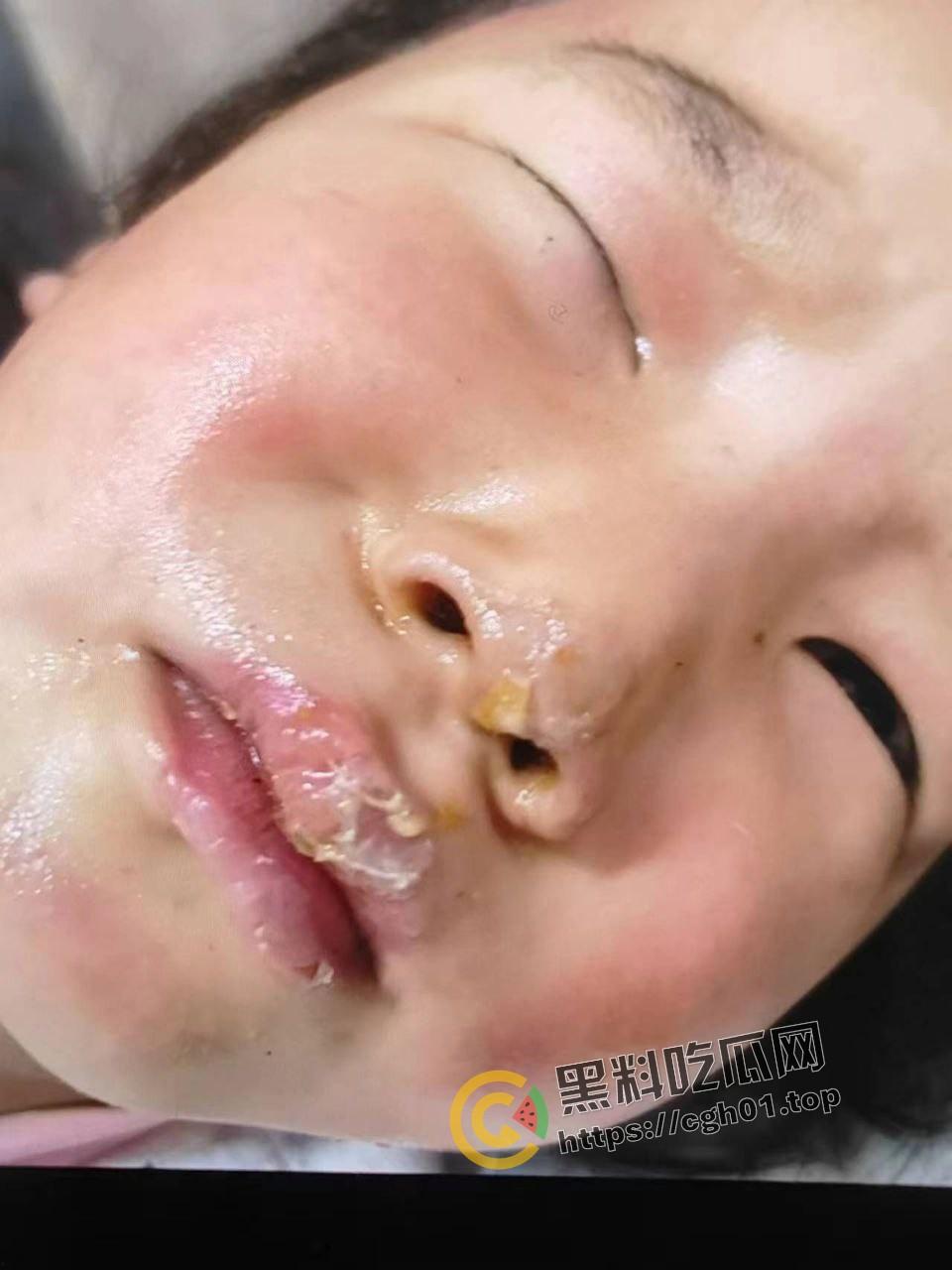 北京马坊镇放火杀人案 犯人【刘峰强】被抓 受害人全身烧烂 手臂被砍 全家老小失去人形 惨不忍睹 血腥慎点-8