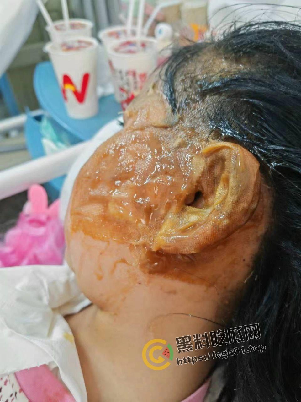 北京马坊镇放火杀人案 犯人【刘峰强】被抓 受害人全身烧烂 手臂被砍 全家老小失去人形 惨不忍睹 血腥慎点-9