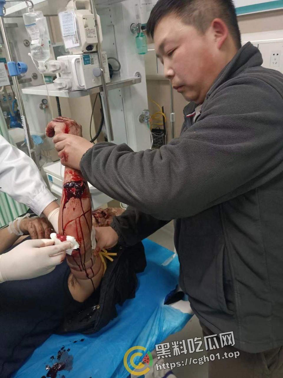 北京马坊镇放火杀人案 犯人【刘峰强】被抓 受害人全身烧烂 手臂被砍 全家老小失去人形 惨不忍睹 血腥慎点-13