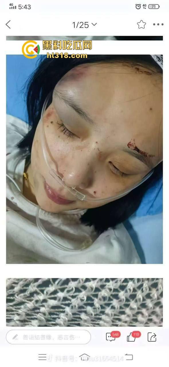 四川江油霸凌事件！持着母亲是公安局副局长就随便霸凌残疾人的孩子？还诱导其父签谅解书，激起民愤！-13