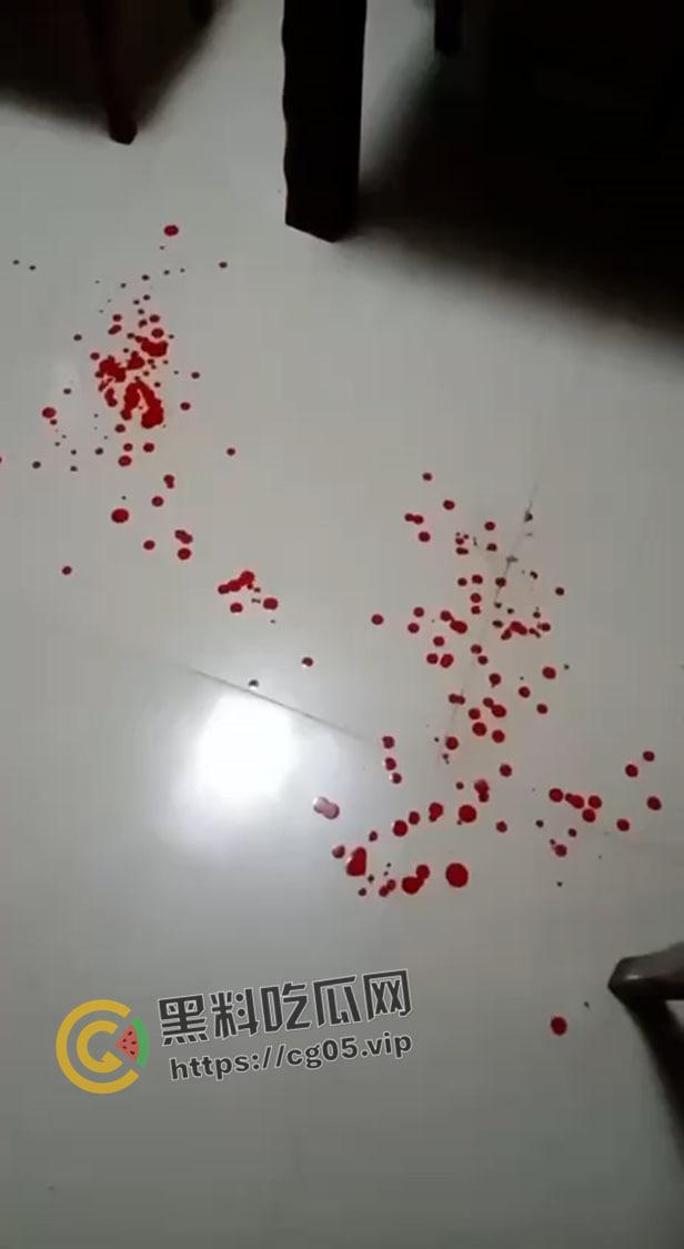 四川蓬安女子遭入户抢劫 微信里只有七百块也被抢走了 还说敢报警杀全家 现场遍地鲜血-3