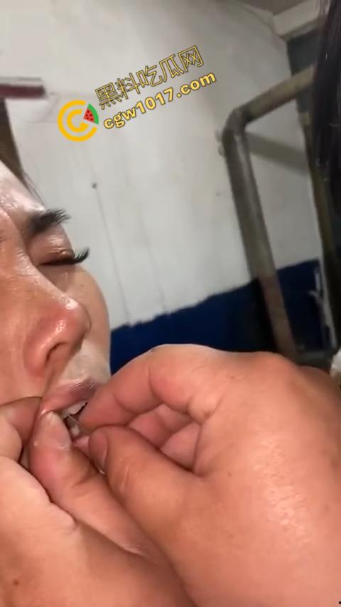 湖南偏僻村庄恐怖游戏：嘴唇缝合，女子痛苦享受，男子冷血针线，极限挑战人，真是够变态-6