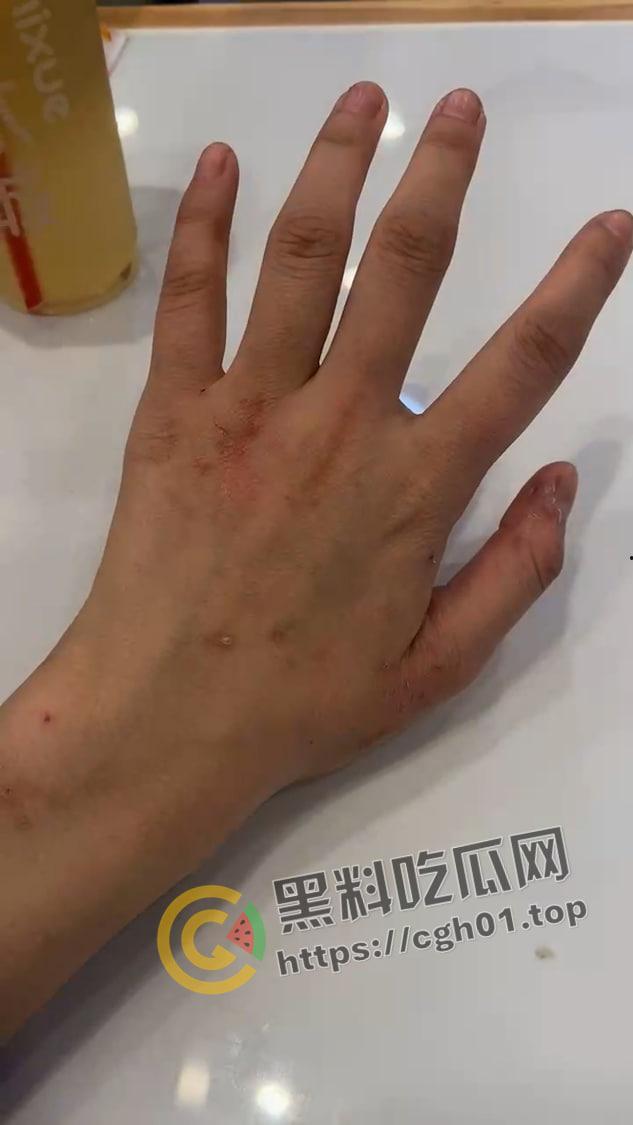 宁波惊现生化母体 圈内全军覆没 医院咨询电话被打爆 夜场公狗母狗的毒圈缩成决赛圈啦-21