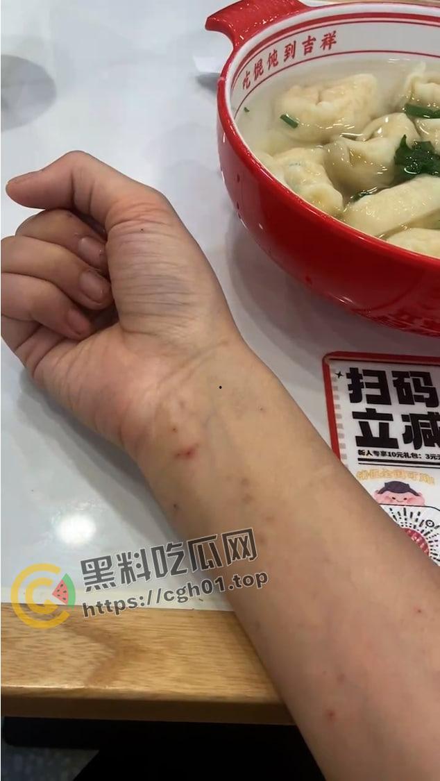 宁波惊现生化母体 圈内全军覆没 医院咨询电话被打爆 夜场公狗母狗的毒圈缩成决赛圈啦-22