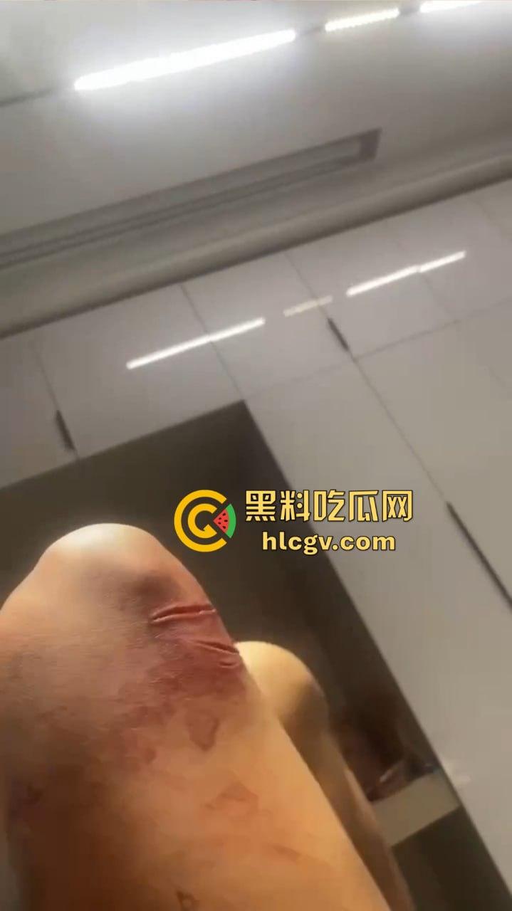 朋友圈成了血腥展示场?王湳权手刃女友后发朋友圈,画面直击心灵,血腥内容慎入!-15