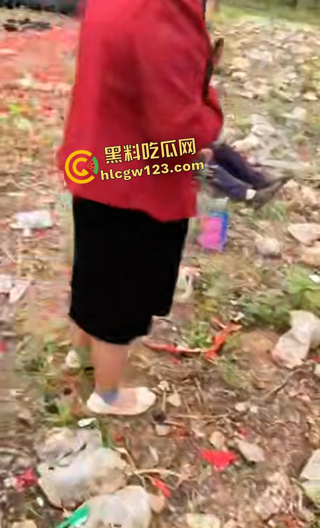 河南平顶山鲁山王大爷捡烟花炸头变黑鬼！右眼已瞎保不住，脑子里有骨头渣！-1