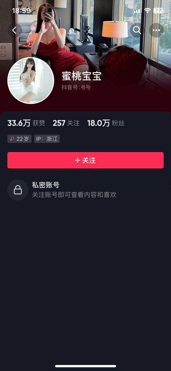 秀人网 抖音 美桃酱 超大尺度高清金主福利 果然卖批是擦边女的归宿-1