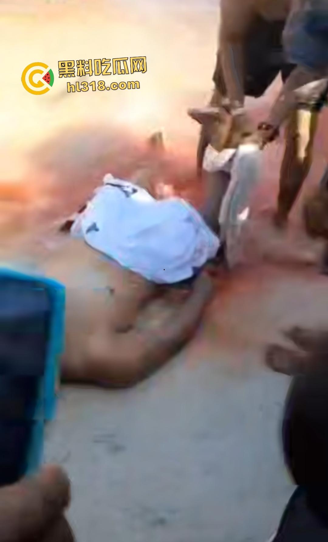 黑人男子海边遭螺旋桨血腥绞杀！下半身肉烂血染红海，旁人妄图复原断肢，谁知身体差点变两半！-8