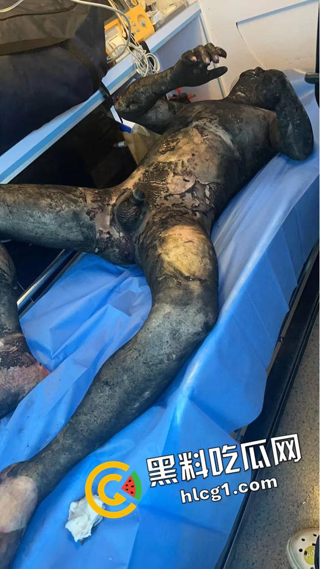 江西宜春江大桥电车着火 驾驶员鸡巴都被烧掉了 浑身烧焦 现场惊悚画面流出-1