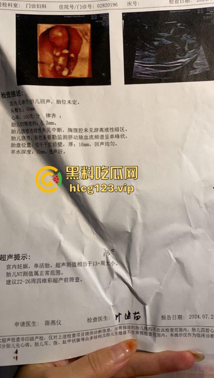 曝光渣男广东揭阳【田文杰】骗婚骗色 逼怀孕女友引产事件完整版-14