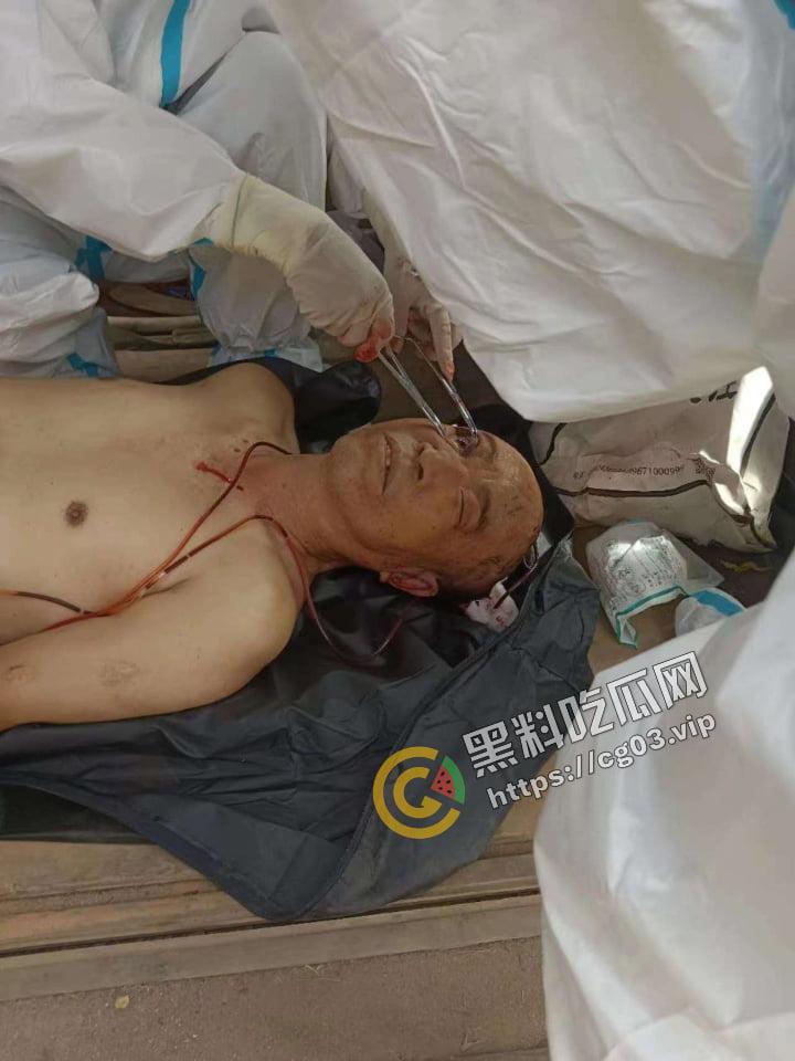 缅甸电诈 四大家族之一的【明学昌】被自杀，尸体拉到中缅边境做尸检 儿子和姑姑自首 现场画面曝光！-7