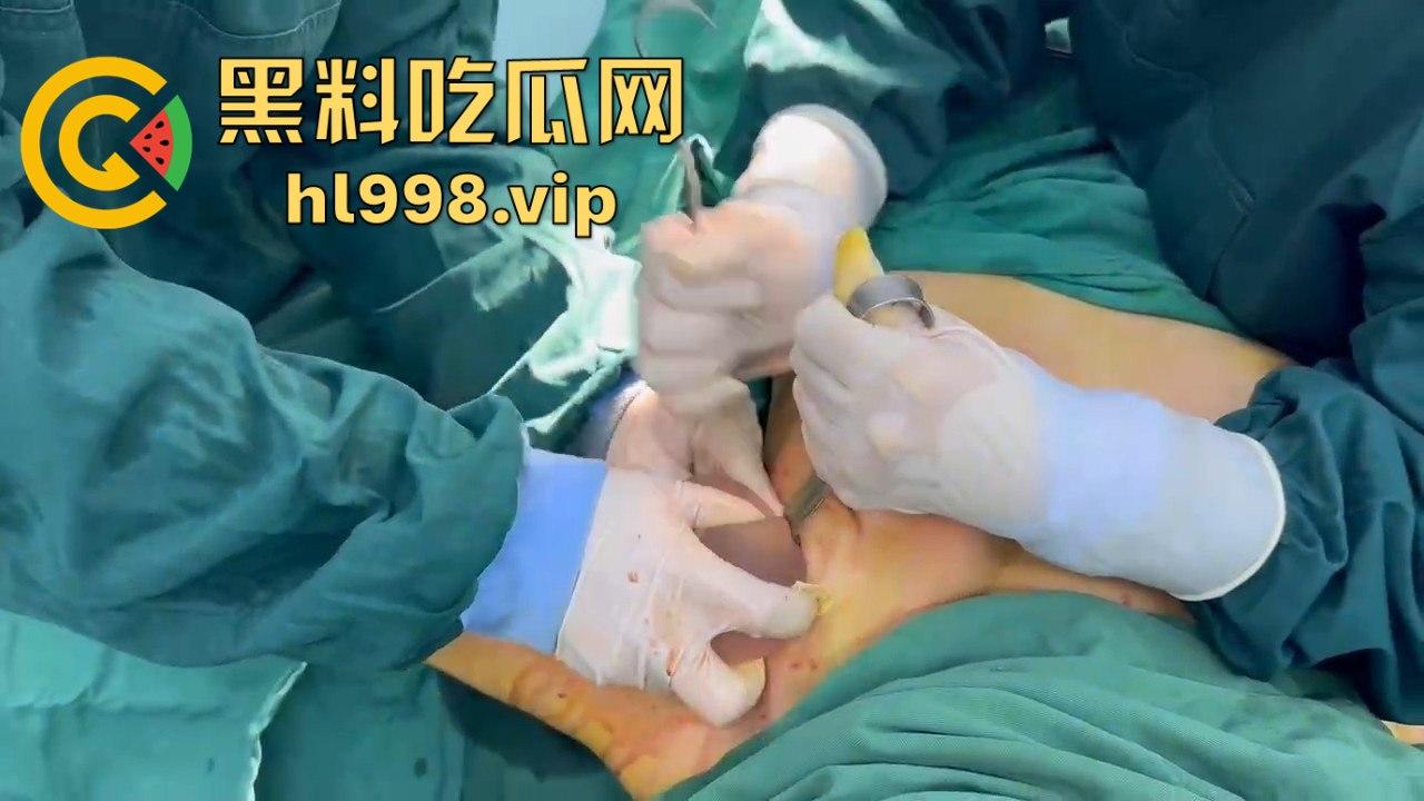 揭秘黄晓明女友『叶柯』同款隆胸术手术过程，看的让人心惊！胸被医生猛戳猛捣，视觉冲击强到不敢看！-15