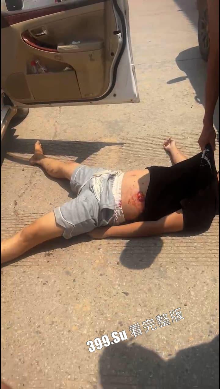 嚣张缅北!牛魔王来了都要犁两亩地 只因擦碰到黑恶势力的车 当街被射杀-5