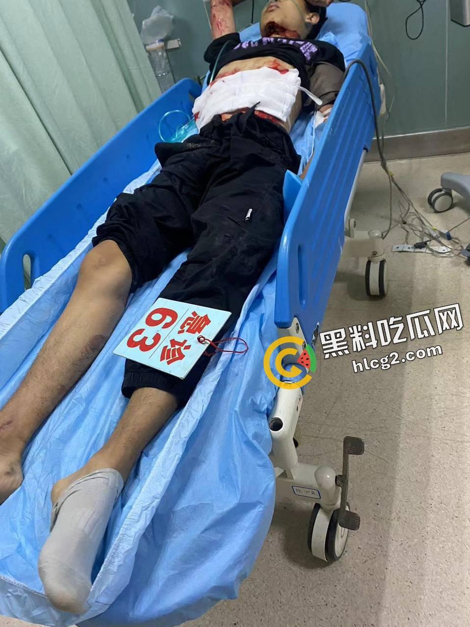 慎人事件!江苏苏州影豹R车主逆行 撞飞摩托车 连人带车坠落引擎盖 重重砸伤晕厥-16