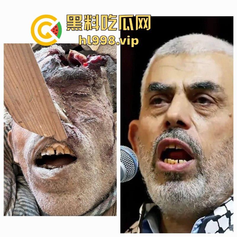 慎入!!!哈马斯领导人辛瓦尔被以方爆头击毙 遗体照片流露不忍直视!-16