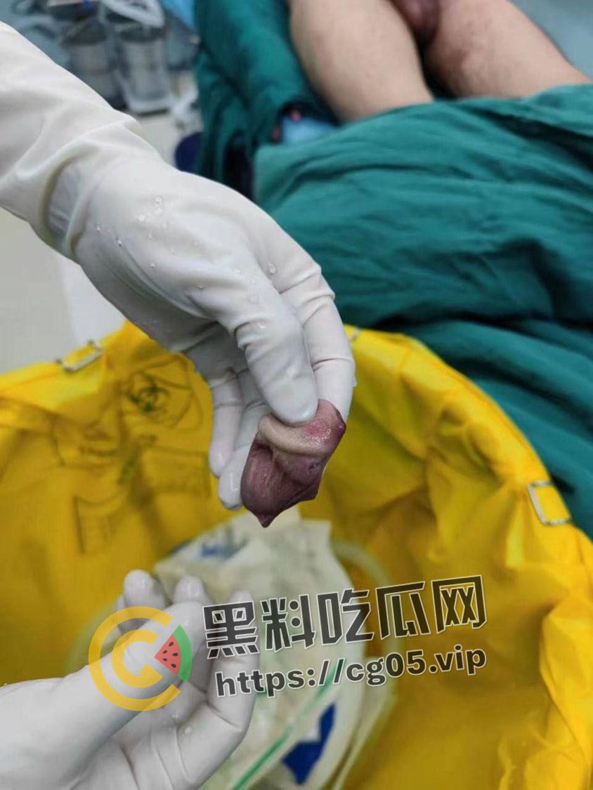 神医在世! 鸡鸡被女友咬断都能接回去 还不影响性功能-1