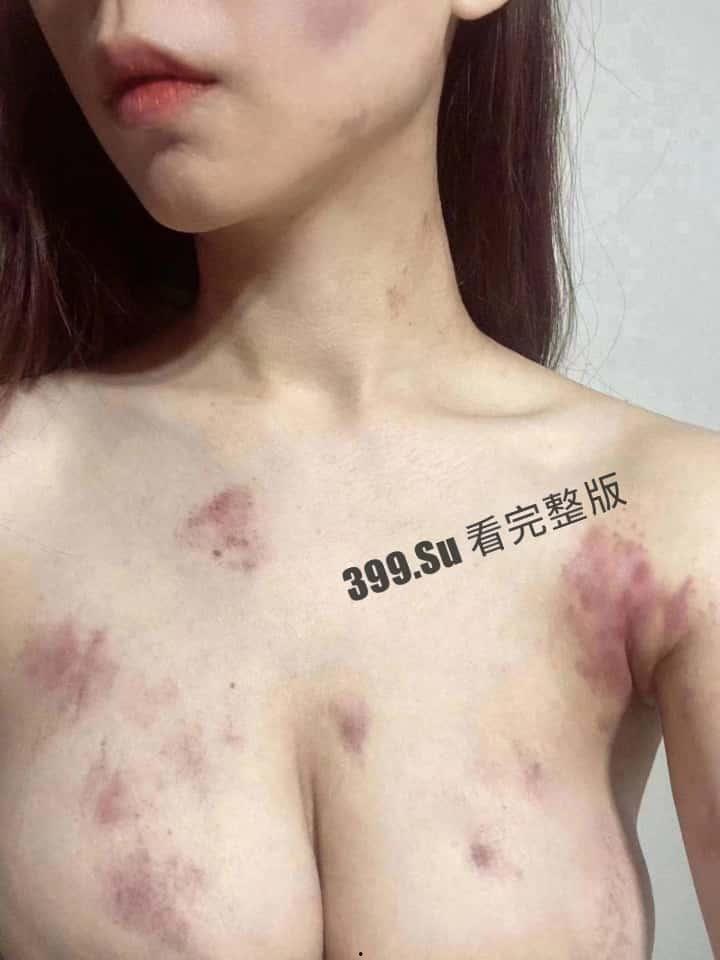 抖音百万粉丝博主 雅典娜 Liya 被闺蜜骗去菲律宾卖进妓院!惨遭毒打、强奸 奶子都被打得青一片紫一片-1