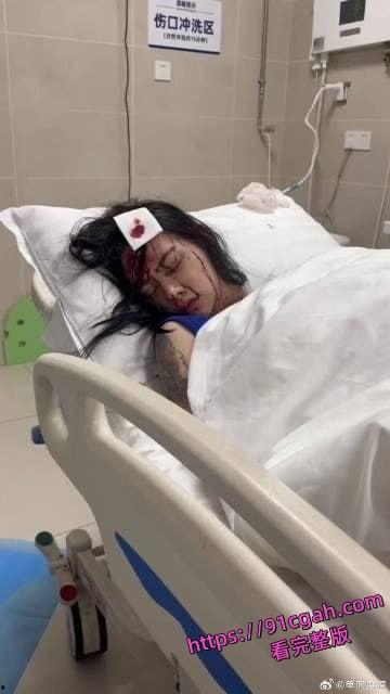 闺蜜当场破防持刀自残!一句“我有你出轨视频”引爆惊天大瓜-6