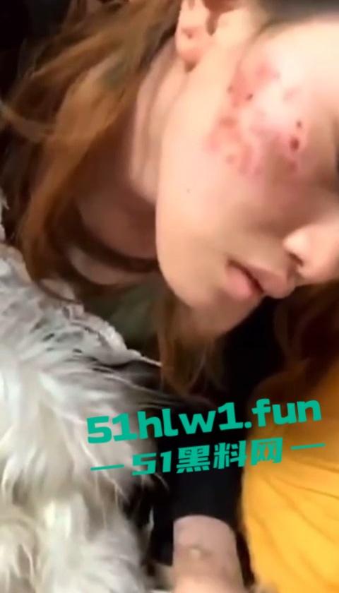 网传河南信阳病毒母体出入啤酒森林酒吧！毒王身体浑身溃烂吓退大量好友，当地交友群已炸开锅！-7