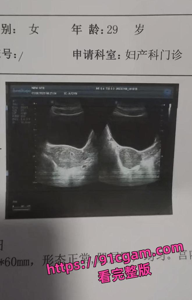 广西容县一男子在路上持刀行凶 还砍伤一名辅警-5