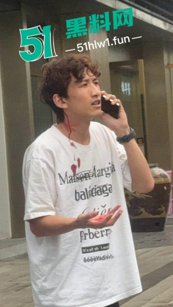 杭州男模【江江】自称网络乞丐，讹上谁就不放过不断纠缠，最终遭人暗算暴打脑袋开瓢。-11