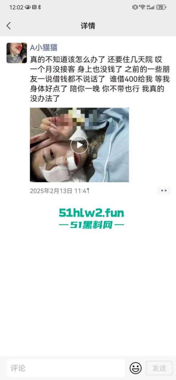 卖惨惯犯纹身妹，骑电瓶车出车祸惨遭破相朋友圈无奈卖身求钱就医，骚货的卖身已成习惯。-9