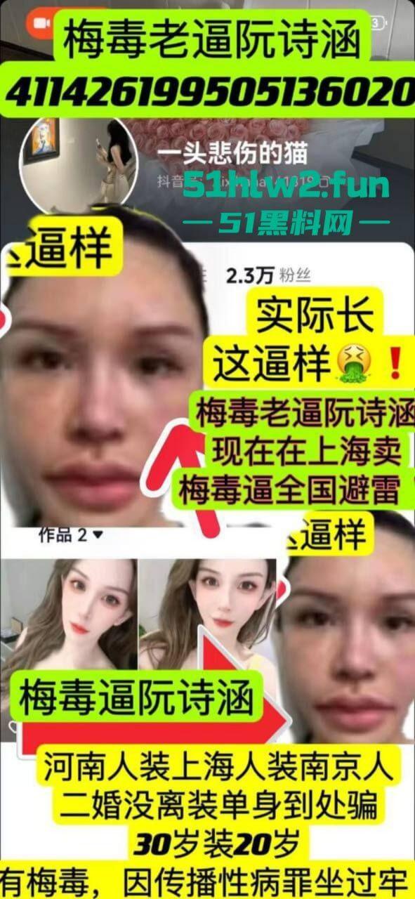 夜场梅毒女【阮诗涵】装嫩卖逼传毒坑害多人，仍在抖音撒网捕鱼专骗老实人全网避雷！-2