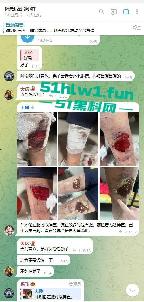 网友爆料：东南亚最黑暗的公司没有之一，妙瓦底七号山庄【阳光集团】管理群殴公司员工视频，聊天记录及老板马亿被扒。-7