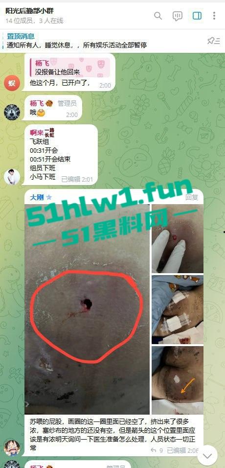 网友爆料：东南亚最黑暗的公司没有之一，妙瓦底七号山庄【阳光集团】管理群殴公司员工视频，聊天记录及老板马亿被扒。-14