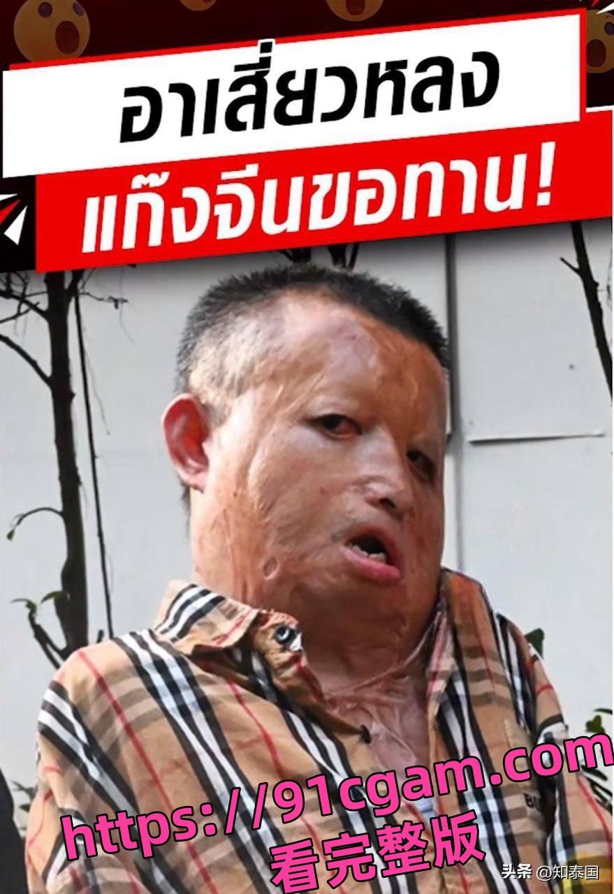 人彘？泰国曼谷惊现中国籍乞讨团！乞讨者失去四肢 且面部严重毁容 ！-2