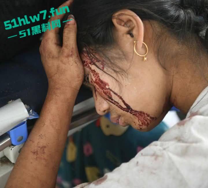 缅甸7.7级震后中国救援队紧急出手仍有众多受难者被压，高温湿臭蚁虫霍乱惨如地狱。-7